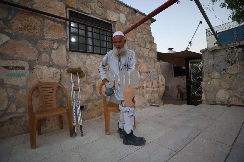 Palestinian man assaulted in Masafer Yatta